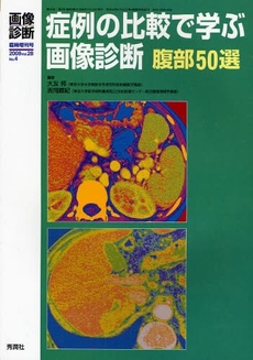 症例の比較で学ぶ画像診断腹部５０選