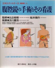 腹腔鏡の手術とその看護