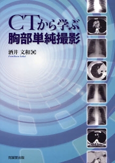 良書網 CTから学ぶ胸部単純撮影 出版社: 克誠堂出版 Code/ISBN: 9784771903388