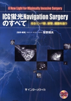 ICG蛍光Navigation Surgeryのすべて