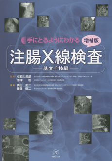 手にとるようにわかる注腸X線検査 基本手技編