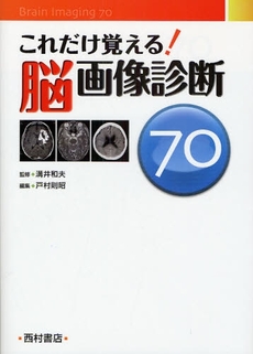 これだけ覚える!脳画像診断70