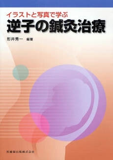 イラストと写真で学ぶ逆子の鍼灸治療