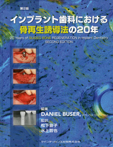 インプラント歯科における骨再生誘導法の２０年