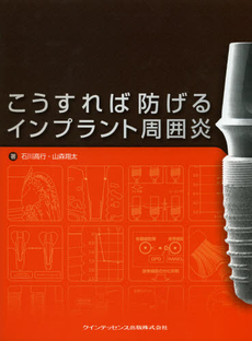 こうすれば防げるインプラント周囲炎