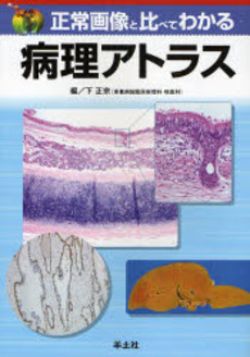 正常画像と比べてわかる病理アトラス