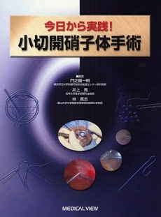 今日から実践！小切開硝子体手術