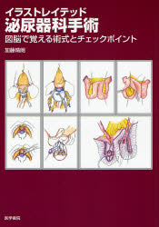 ｲﾗｽﾄﾚｲﾃｯﾄﾞ泌尿器科手術