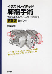 良書網 ｲﾗｽﾄﾚｲﾃｯﾄﾞ肺癌手術 第2版 出版社: 日本言語聴覚士協会 Code/ISBN: 9784260004619