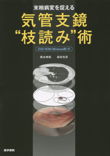 良書網 末梢病変を捉える気管支鏡“枝読み”術 出版社: 医学書院 Code/ISBN: 9784260020725