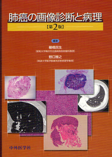 良書網 肺癌の画像診断と病理 出版社: 中外医学社 Code/ISBN: 9784498031760