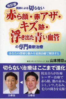 医師による切らない「赤ら顔・赤アザ・キズ跡・浮き出た青い血管」の専門最新治療