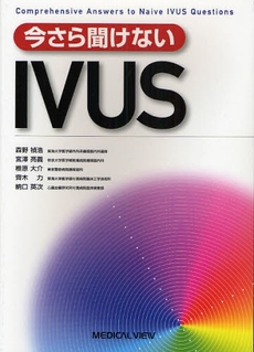 今さら聞けないＩＶＵＳ